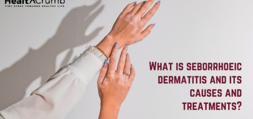 What is seborrhoeic dermatitis and its causes and treatments?