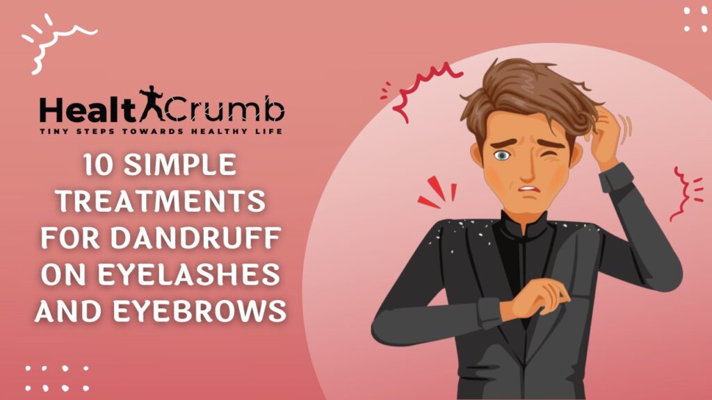 10 Simple Treatments for Dandruff on Eyelashes and Eyebrows