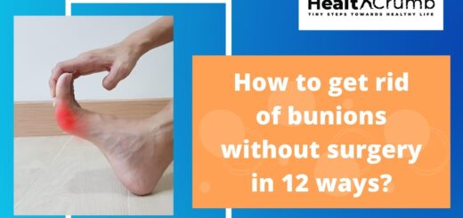 How to get rid of bunions without surgery in 12 ways