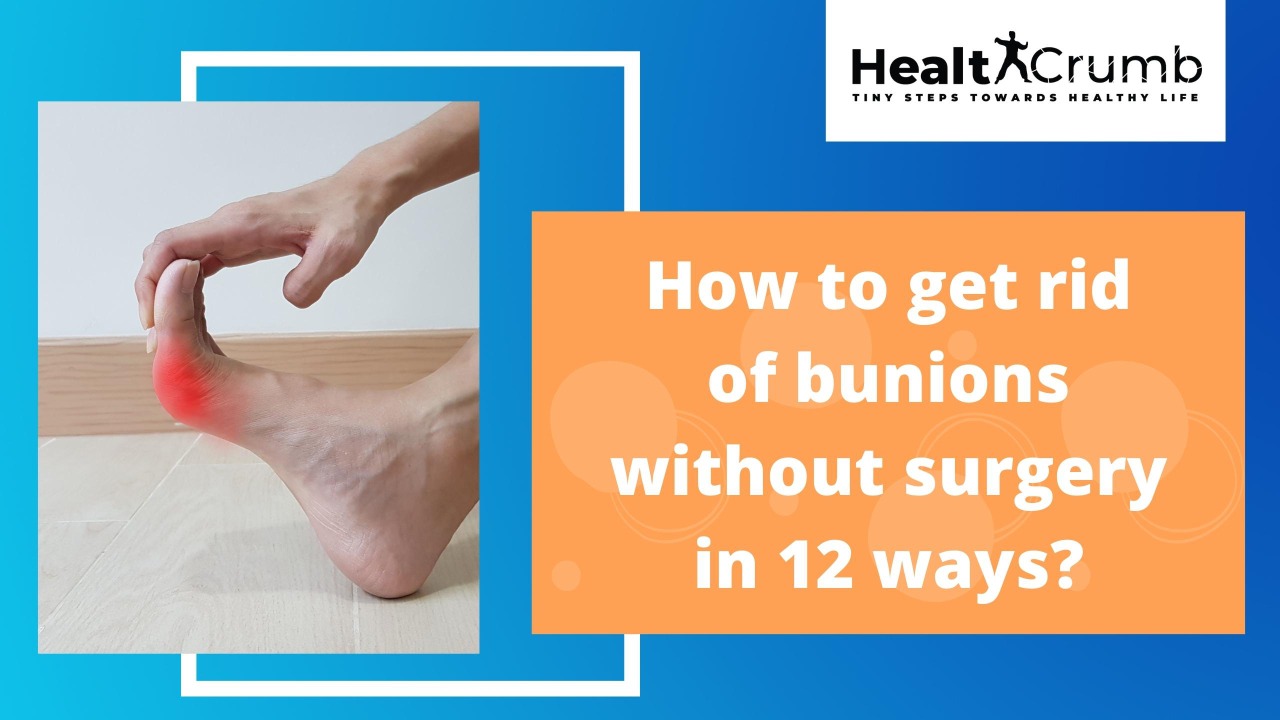 How to get rid of bunions without surgery in 12 ways