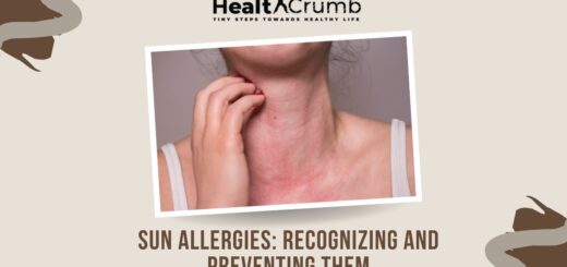 Sun Allergies: Recognizing and Preventing Them