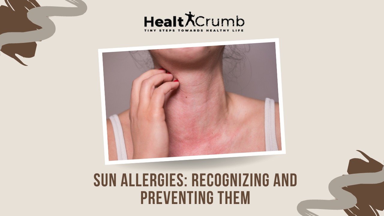 Sun Allergies: Recognizing and Preventing Them