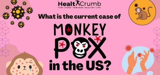 What is the Current Case of Monkeypox in the US?