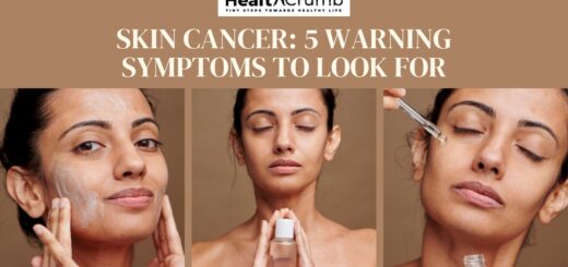 Skin Cancer: 5 Warning Symptoms To Look For